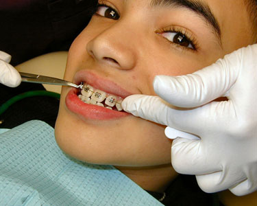 Kids Kissimmee: Orthodontists - Fun 4 Kissimmee Kids