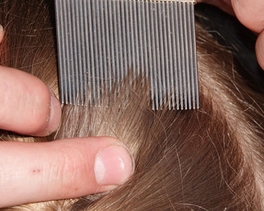 Kids Kissimmee: Lice Treatment - Fun 4 Kissimmee Kids